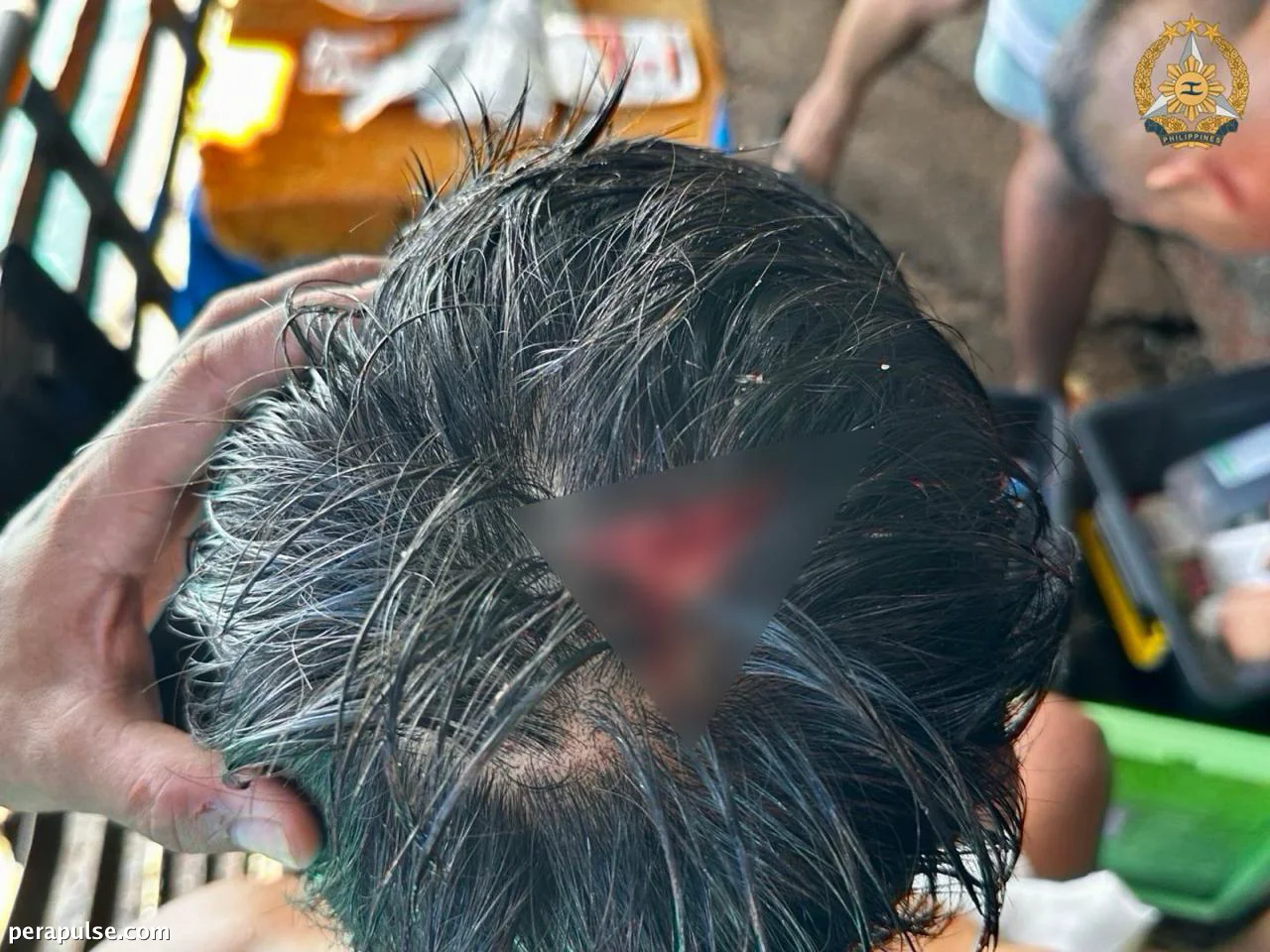 DND Kinondena ang Atake ng CCG sa mga Tauhan ng Philippine Navy sa Ayungin Shoal