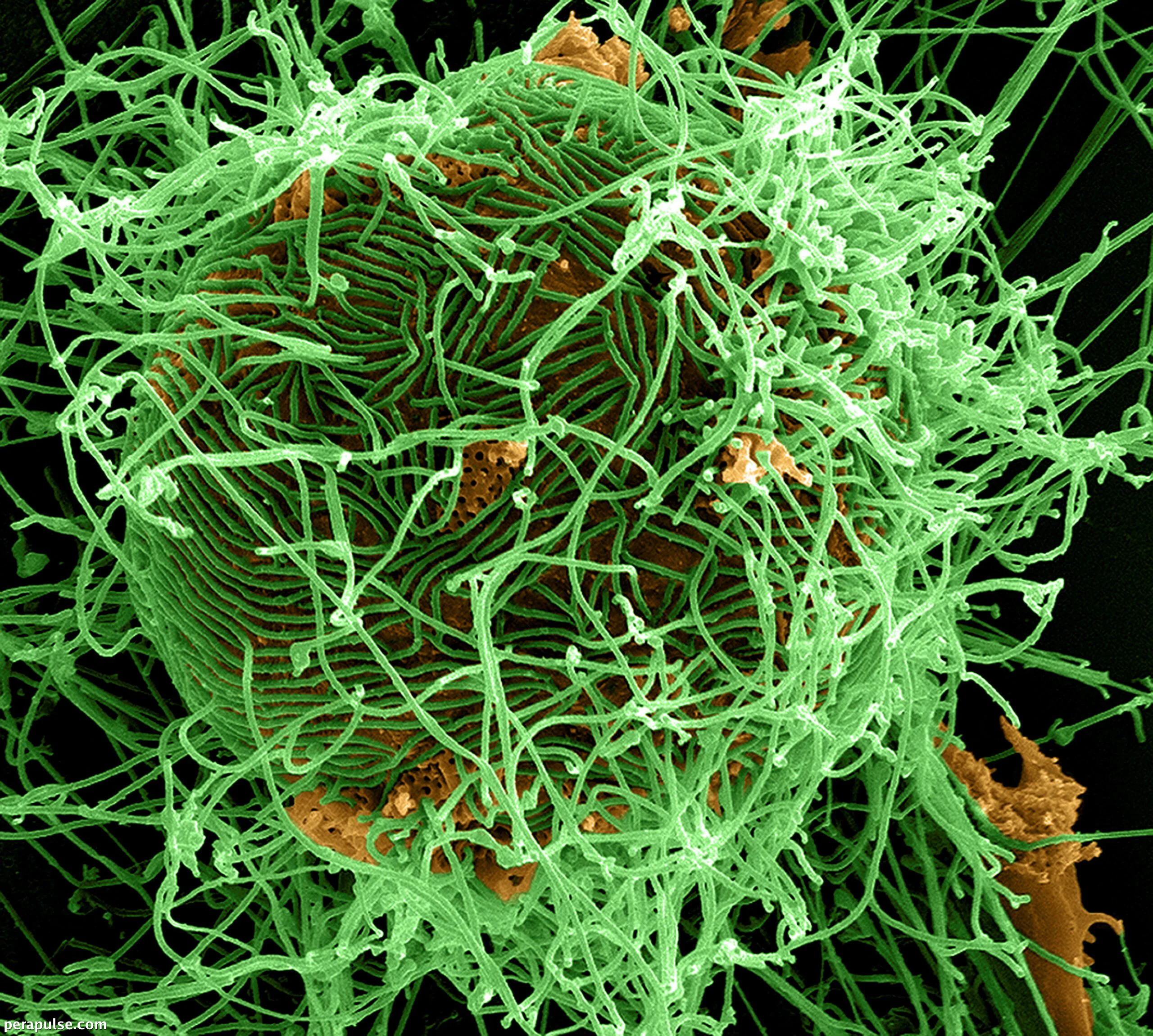 Pag-unawa sa Bundibugyo Strain ng Ebola Virus